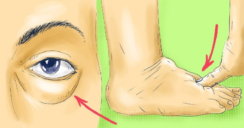 Отеки на ногах картинки