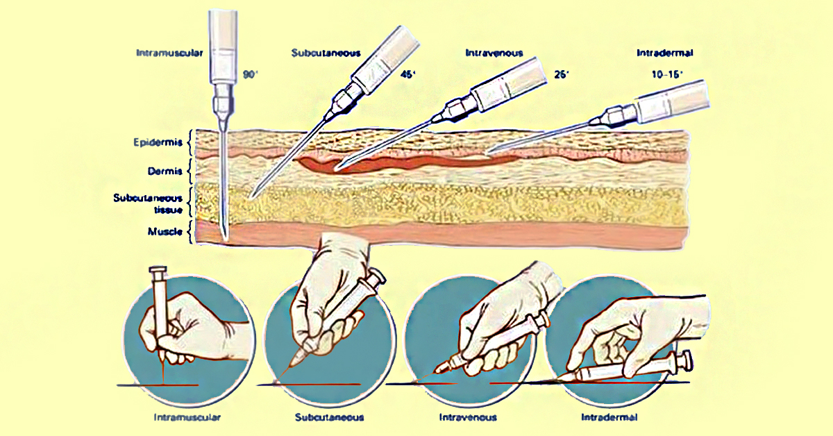 Картинки внутрикожной инъекции
