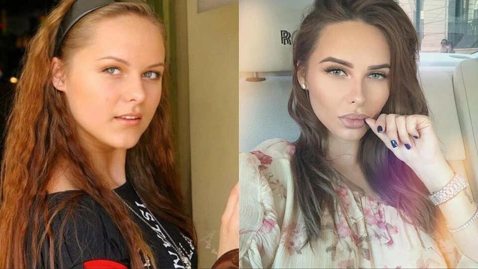 Ханна до пластики фото до и после фото певица