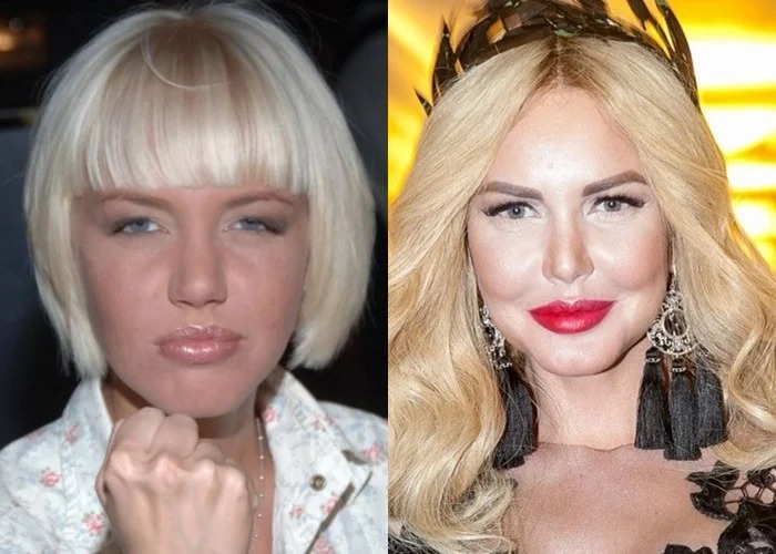 7 знаменитых блондинок, которые решились на ринопластику